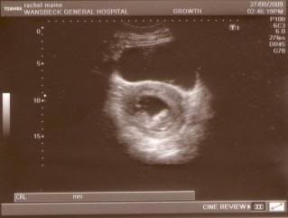 babybean0002.jpg