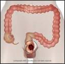 Colon.jpg