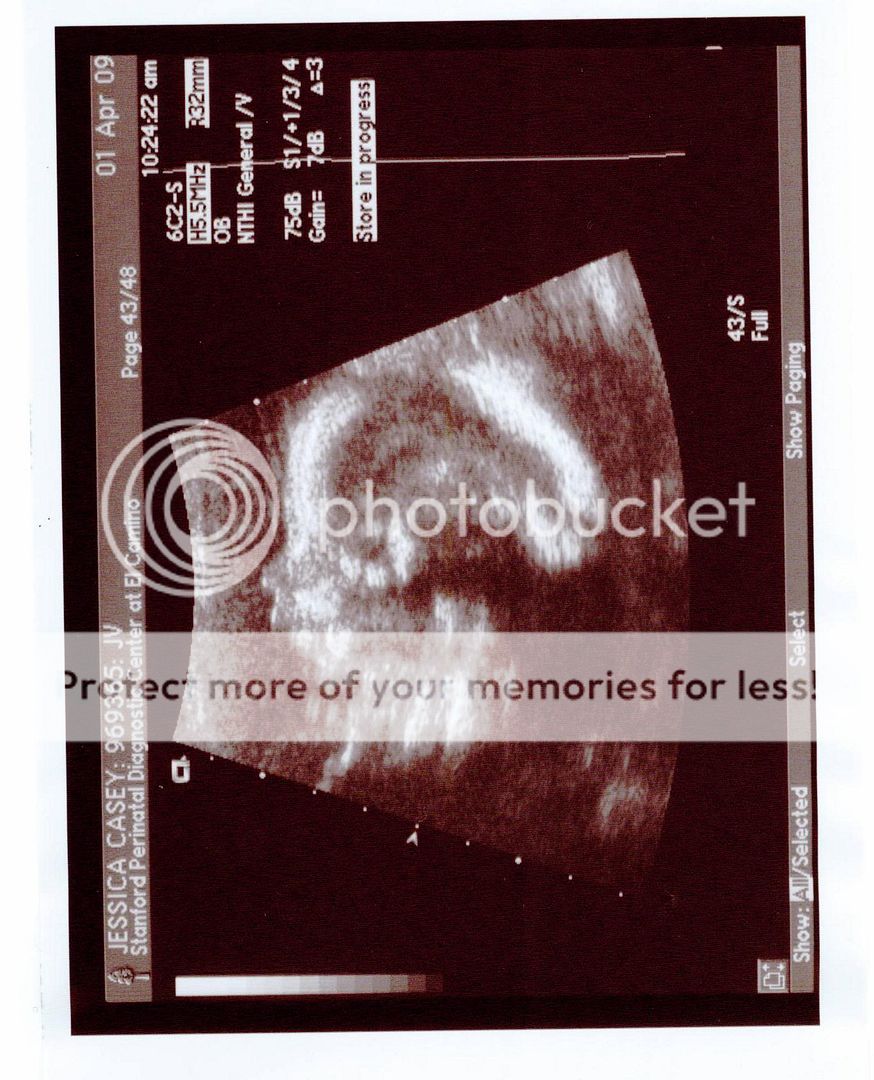 Baby Brindle Profile